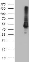 Monoclonal Mouse anti-Human CPA1 / Carboxypeptidase A Antibody (clone OTI2E3, IHC, IF, WB)