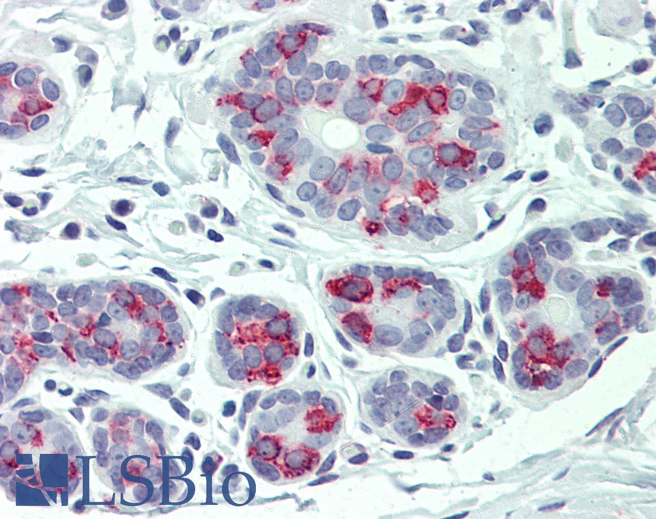 IHC-plus™ Polyclonal Rabbit anti-Human ITGA6/Integrin Alpha 6/CD49f Antibody (Internal, IHC)