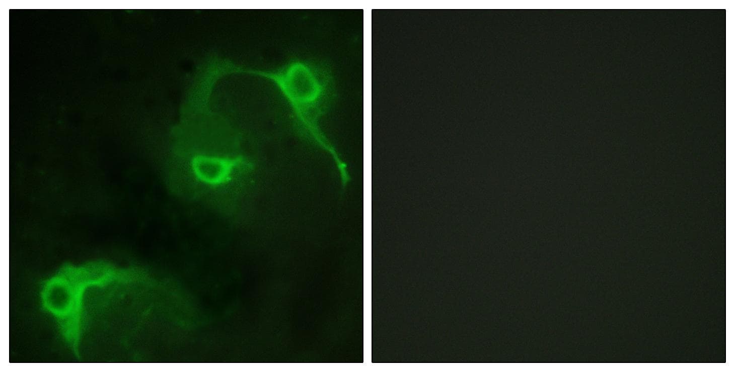Polyclonal Rabbit anti-Human VAV2 Antibody (p142, IHC, IF, WB)