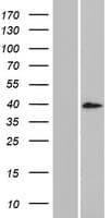 DCDC1 Protein (Over-Expression Lysate Myc-DDK (Flag))