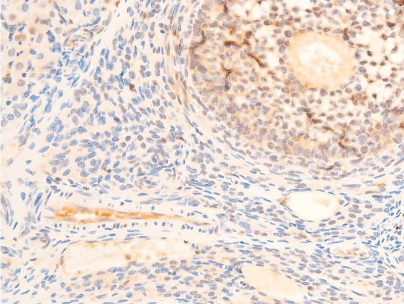PDPK1 / PDK1 Antibody (phospho-Ser241)