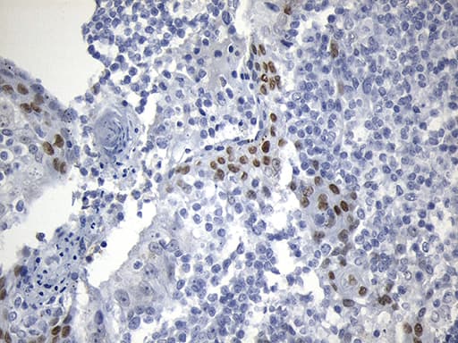 Monoclonal Mouse anti-Human OIP5 Antibody (clone OTI1F1, IHC, WB)