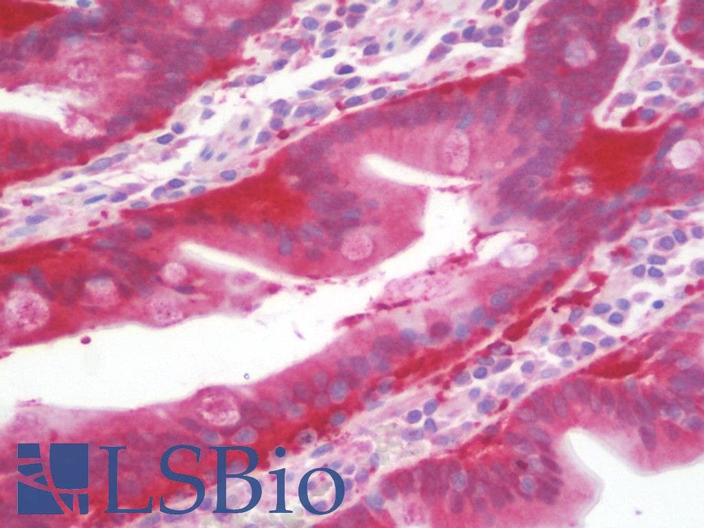 IHC-plus™ MRPS9 Antibody (aa91-140)