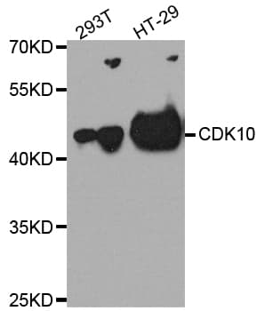 Polyclonal Rabbit anti-Human CDK10 Antibody (IHC, WB)