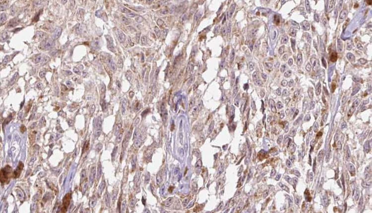 IL18 Antibody
