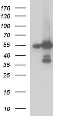 FGG / Fibrinogen Gamma Antibody (clone OTI2D2)