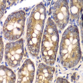 Polyclonal Rabbit anti-Human Osteonectin / SPARC Antibody (IHC, WB)