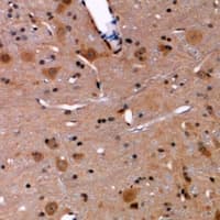 COLEC11 Antibody