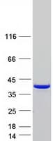 Human CAB39L Protein (Recombinant Myc-DDK (Flag))