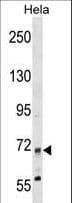 Polyclonal Rabbit anti-Human MTMR14 Antibody (aa18-45, WB)
