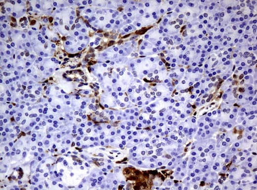 TP / Thymidine Phosphorylase Antibody (aa311-482, clone UMAB97)