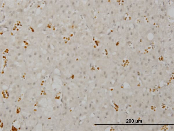 SMG1 / ATX Antibody (clone 1C12)