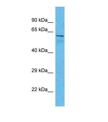 Polyclonal Rabbit anti-Human AKAP8L Antibody (aa531-580, WB)