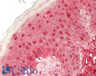 IHC-plus™ CSTB / Cystatin B / Stefin B Antibody