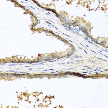 SOST / Sclerostin Antibody