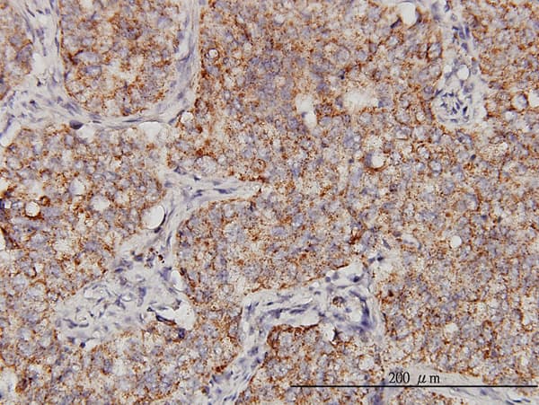 PPOX Antibody (clone 2F10)