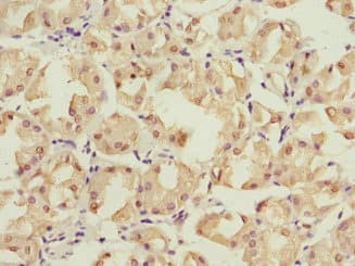 PSMD12 / Rpn5 Antibody