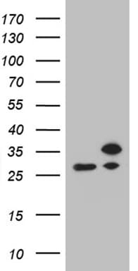 RPL10A Antibody (clone OTI4B2)
