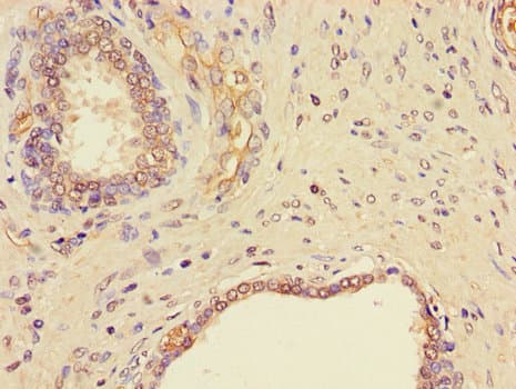NGF Antibody