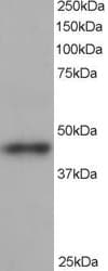 IHC-plus™ ACTR1B Antibody (aa363-375)