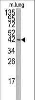 MAPK14 / p38 Antibody (Thr180/Tyr182)