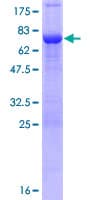 Human TBC1D16 Protein (Recombinant GST)