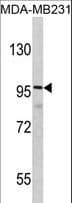 DLGAP1 Antibody (aa162-190)