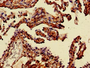 MAN2A1 / Mannosidase II Antibody