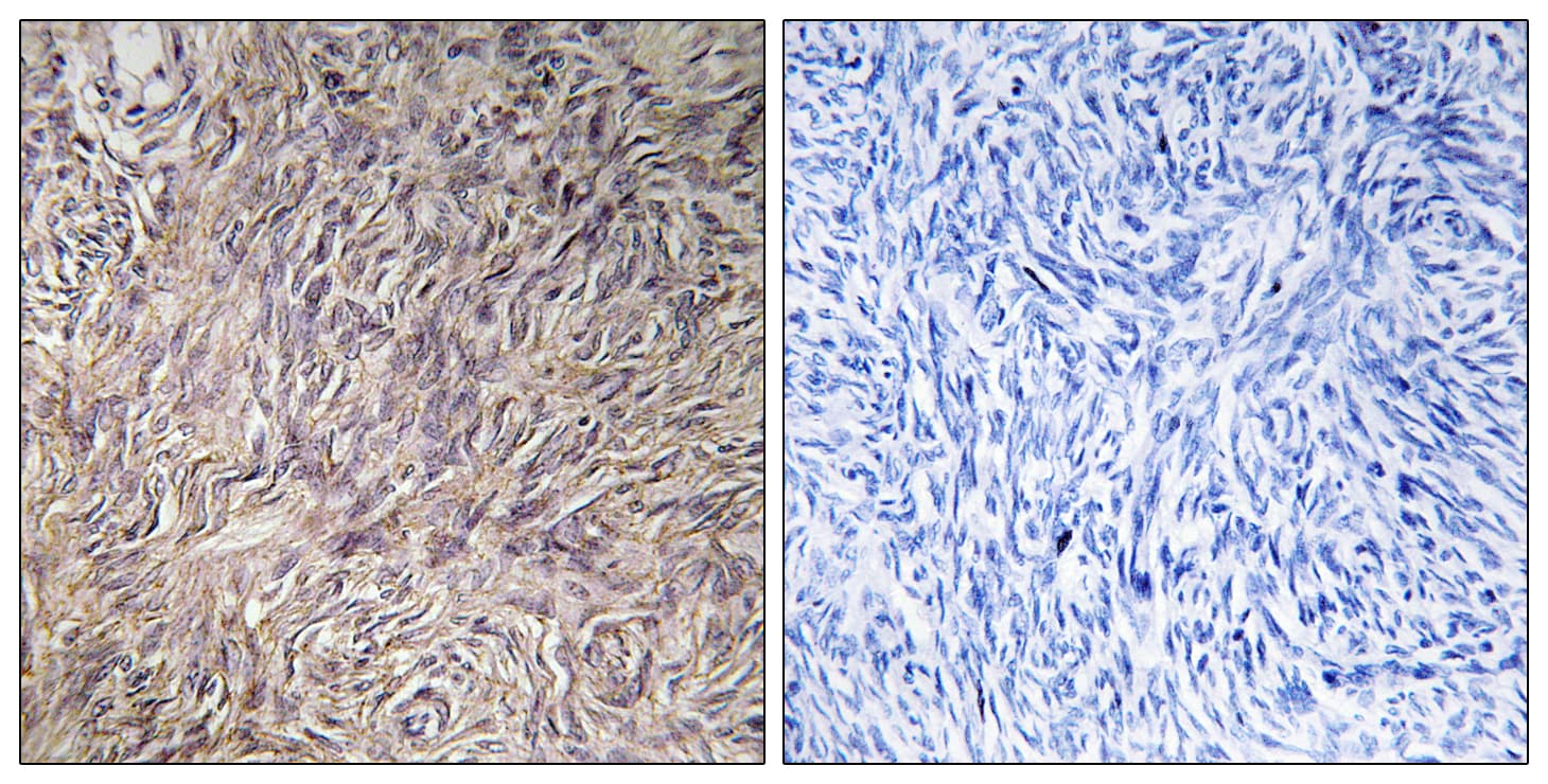 FGF22 Antibody (aa71-120)