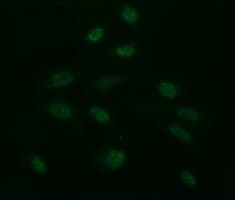 Monoclonal Mouse anti-Human CD163 Antibody (clone OTI2C1, IF, WB)