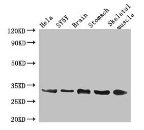 Polyclonal Rabbit anti-Human GJB3 / CX31 / Connexin 31 Antibody (aa211-270, IHC, WB)