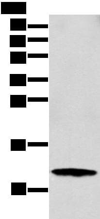 Polyclonal Rabbit anti-Human S100A16 Antibody (IHC, WB)