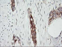 RARRES1 Antibody (clone OTI1D2, Carrier-free)
