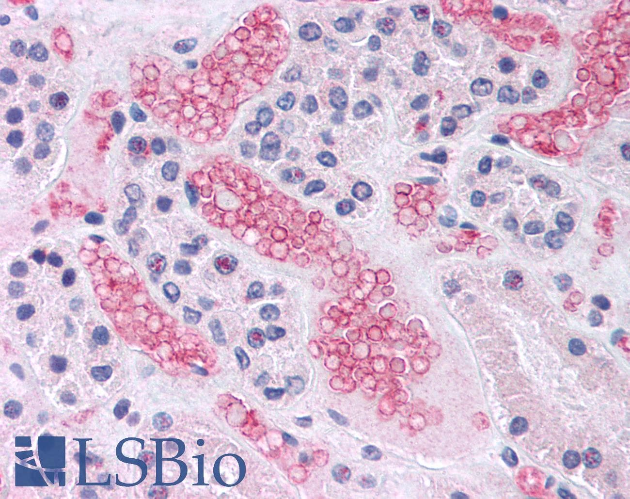 IHC-plus™ Band 4.1 / EPB41 Antibody