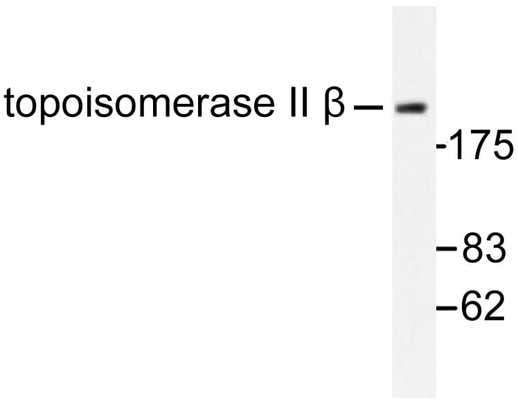 TOP2B / Topoisomerase II Beta Antibody (Ala32)