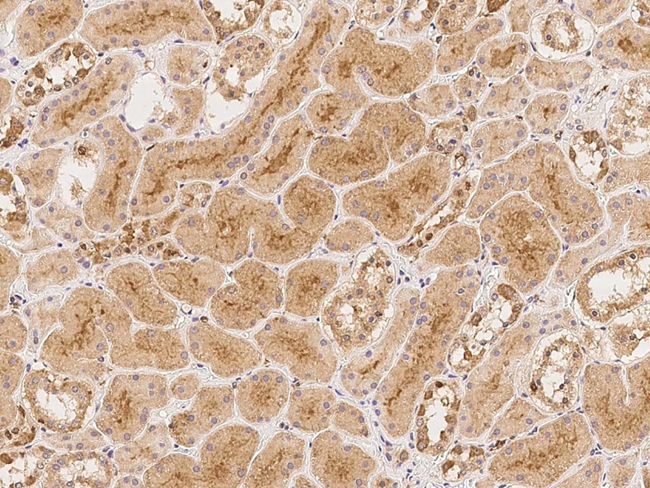 KIAA0652 / ATG13 Antibody