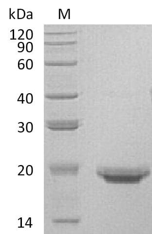 Human IL17F Protein (Recombinant 6His, C-terminus)