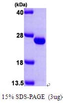 Human FXN / Frataxin Protein (Recombinant His)