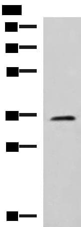 Polyclonal Rabbit anti-Human JAM3 Antibody (IHC, WB)