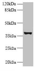 UBLCP1 Antibody