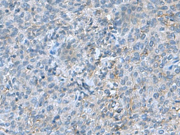 SRPK2 Antibody