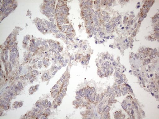 PD-L2 / PDCD1LG2 / CD273 Antibody (clone OTI7B10)