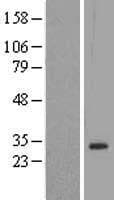 DLX1 Protein (Over-Expression Lysate Myc-DDK (Flag))