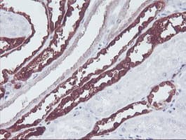KIF2C / MCAK Antibody (clone OTI1C5)