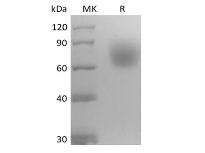 Mouse NTRK2 / TRKB Protein (Recombinant 6His, C-terminus)