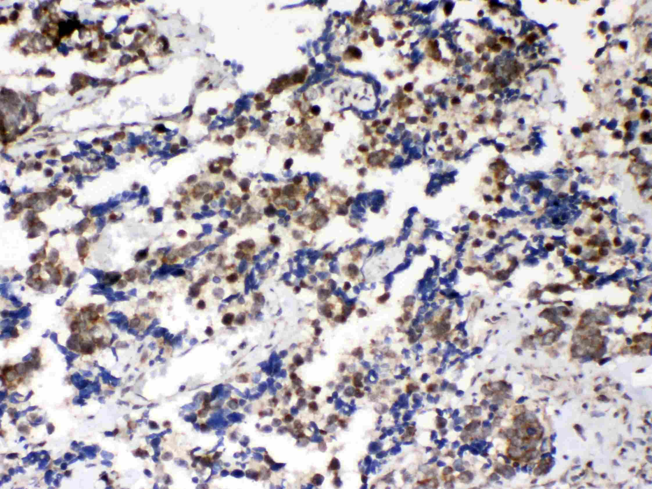 Polyclonal Rabbit anti-Human MSI1 / Musashi 1 Antibody (IHC, WB)