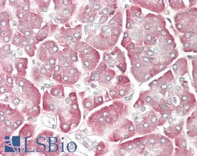 CCL15 / MIP5 Antibody (aa22-113)