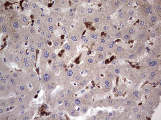 LGALS3 / Galectin 3 Antibody (clone OTI7G9)