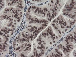 Monoclonal Mouse anti-Human TPRKB Antibody (clone OTI1E9, IHC, WB)