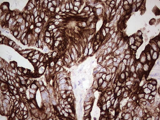 KRT19 / CK19 / Cytokeratin 19 Antibody (aa240-390, clone UMAB186)